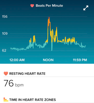 Screencap showing the onset of the arrhythmia. Image: AEM